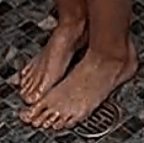 feet Roisin 8-2-22 3