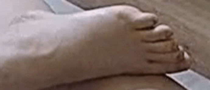 foot Annabella 2-14-23