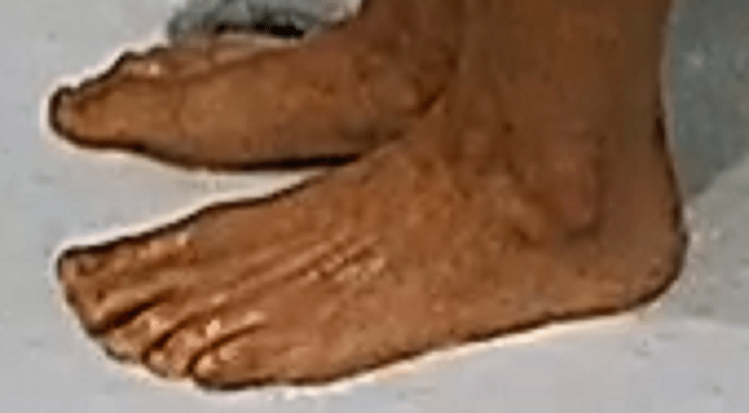 feet Sarah 9-9-22