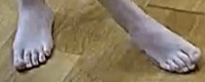 feet Marica 9-21-22 2