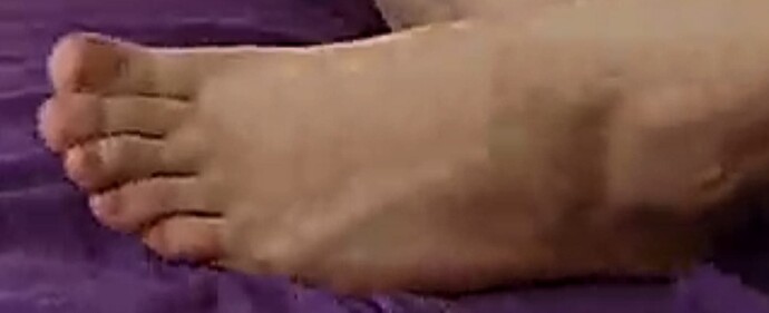 foot Goldie 8-18-22 2