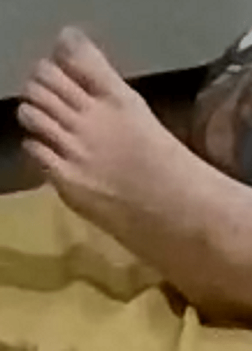 foot Elisha 10-18-22
