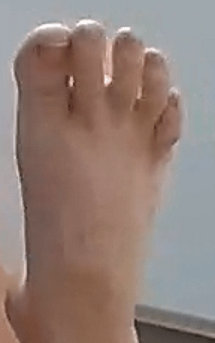 foot Ailya 7-10-22 3