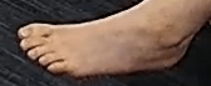 foot Chyna 9-18-22