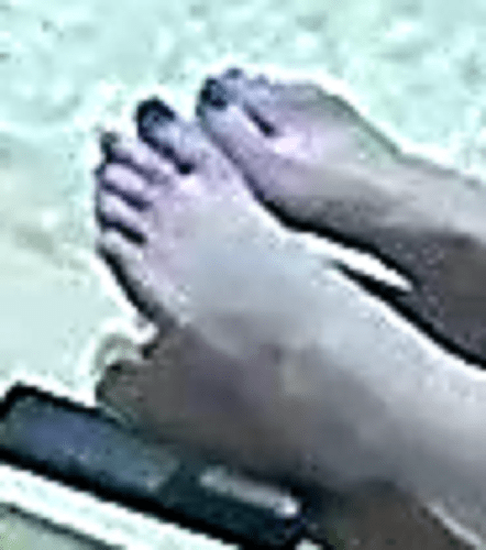 feet Misty 2