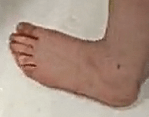 foot ASGG 7-17-22