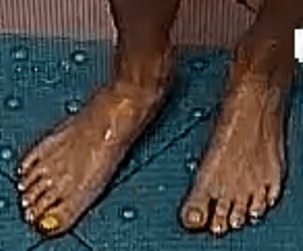 feet Cindy 10-30-22