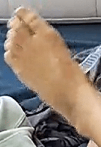 foot Auriel 5-20-22 2