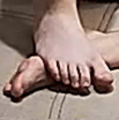 feet Winston W 11-16-22