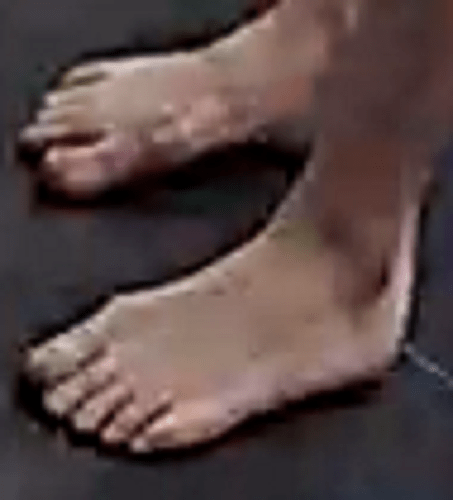 feet Sassy 9-5-22