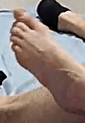 foot Camille