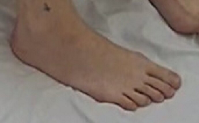 foot Geraldine 2-17-23
