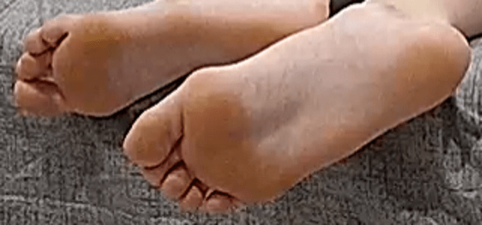 Astrid feet 3-31-22