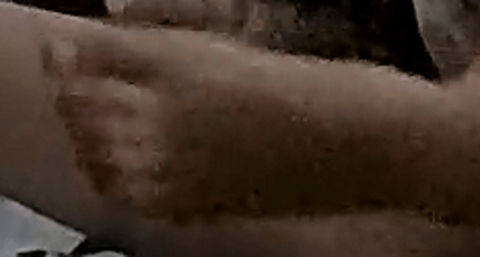 better foot shot