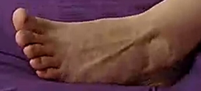 foot Goldie 8-18-22 1