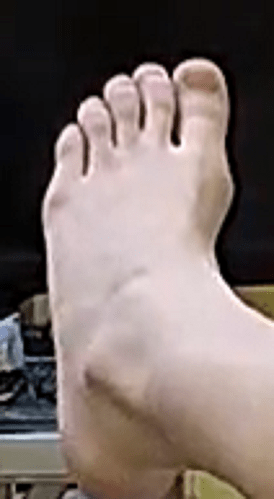 foot Chloe