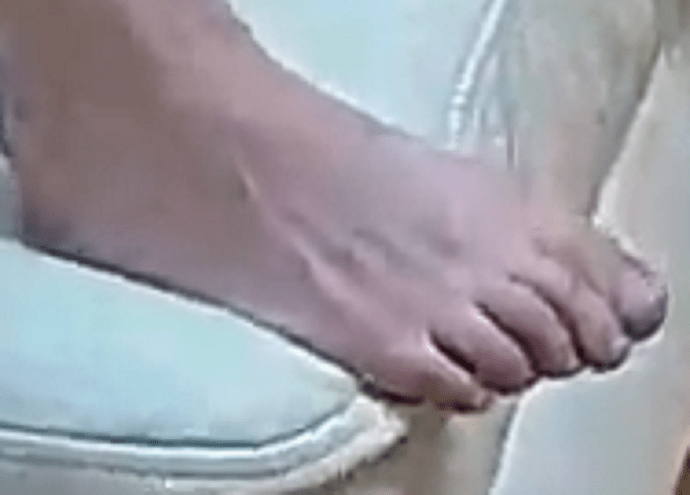 foot Carolyn 7-18-22