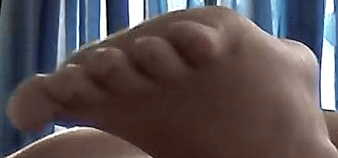 foot Geri 3-16-17