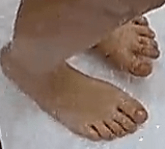 feet Flora 1-17-23