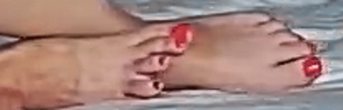 feet Misty