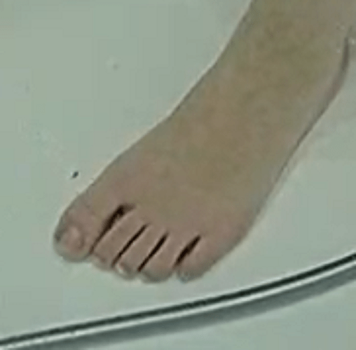 foot Ariela 5-26-22