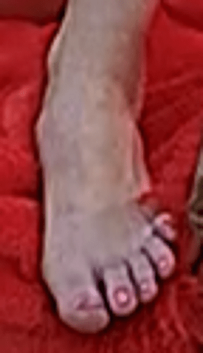 foot Alisa 9-20-22