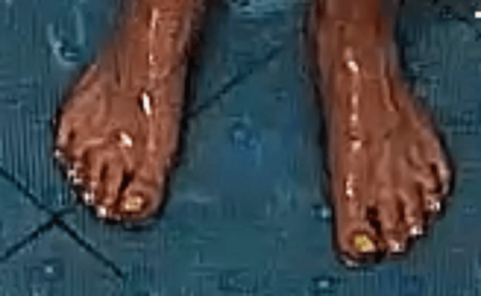 feet Cindy 10-30-22 2