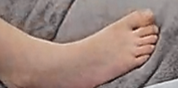 foot Chyna 9-6-22