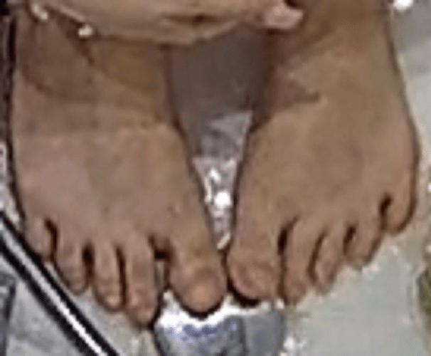 feet Alicia 3-16-23 2
