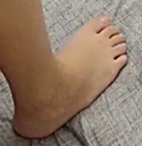 foot Flora 1-21-23