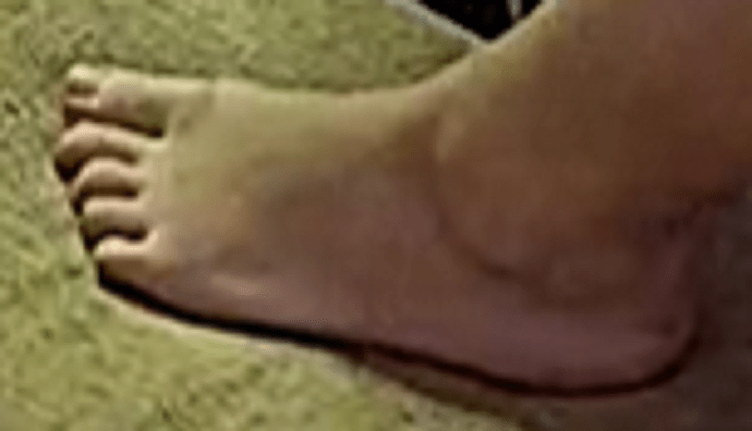 foot B&T 1-6-23