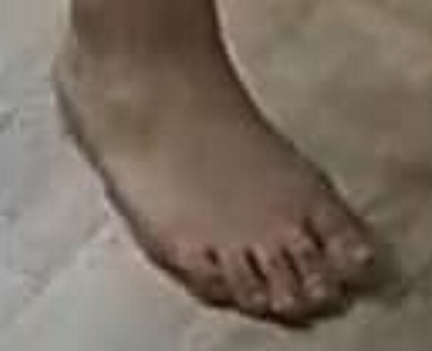 foot Goldie 1-25-23