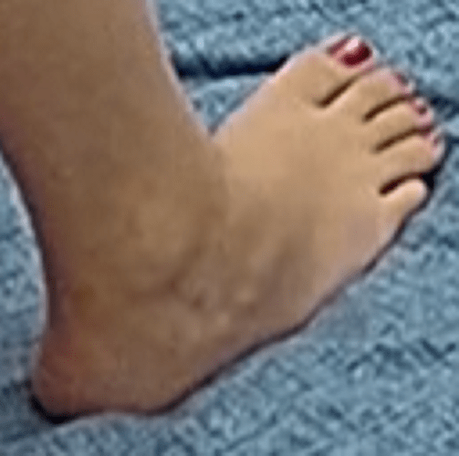 foot Flora 3-4-23