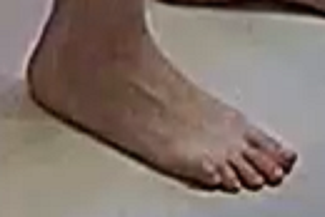 foot Alisa 8-4-22