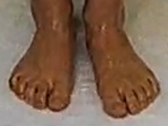 feet Aurial 6-2-22
