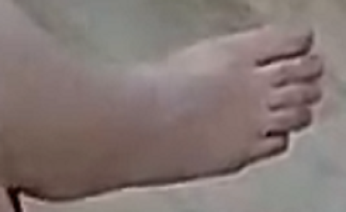 foot Indira 5-9-22