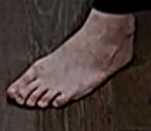 foot Goldie 11-28-22