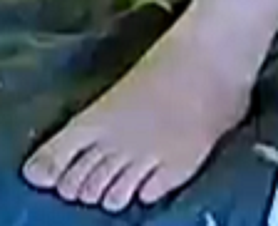 foot Ariela 1-17-23