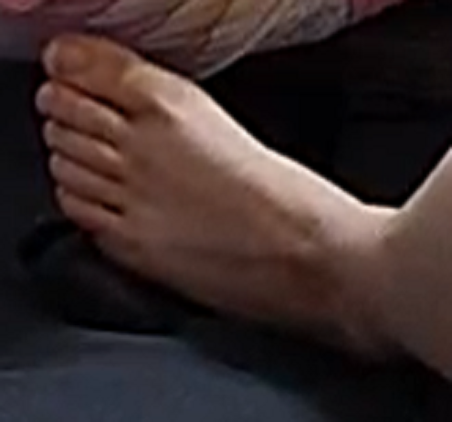 foot Flame 1