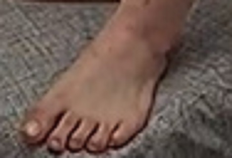 foot Cherry 4-6-23 2