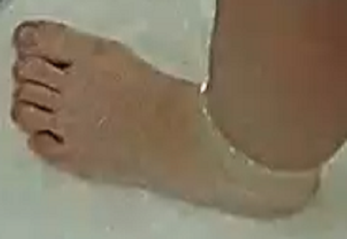 foot Ariela 4-29-22