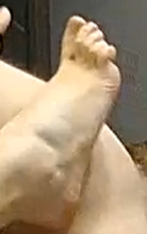 Evared foot 3