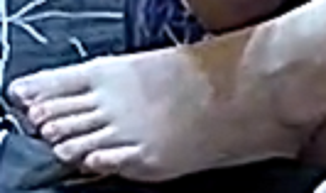 foot Ariela 1-14-23 1