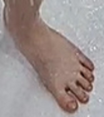foot Amandina 3-7-23