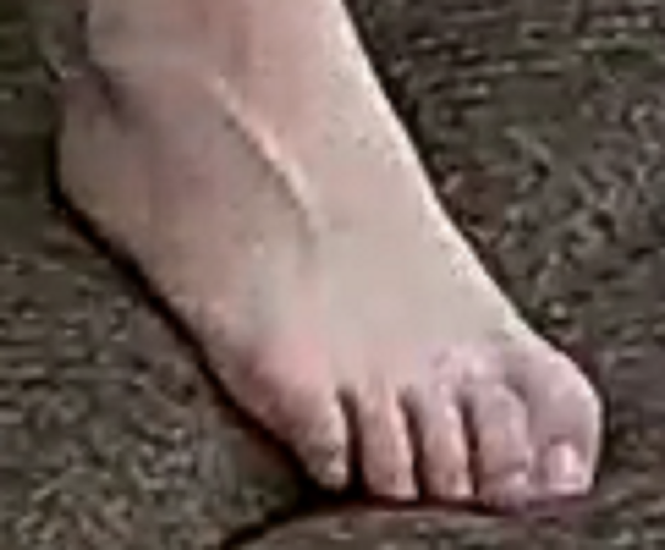 foot Alisa 12-22-22