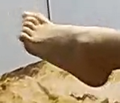 Evared foot 1