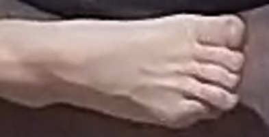 Dilara foot 1