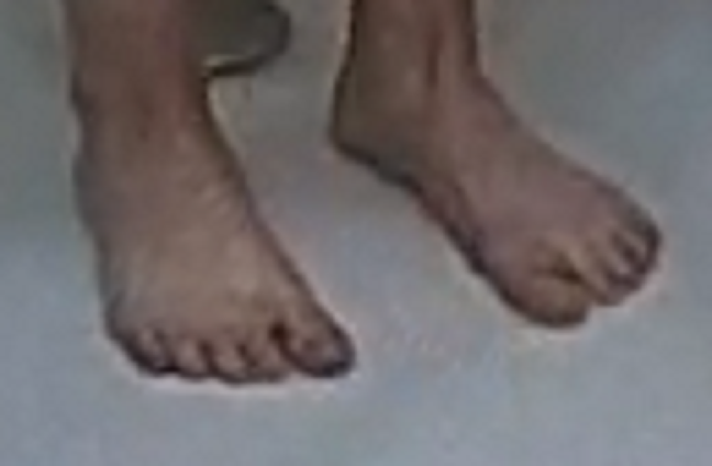 feet Wynona 5-21-22