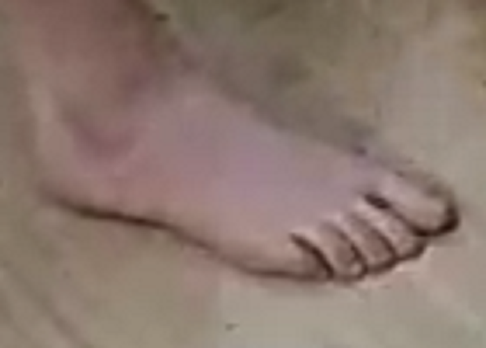 foot Debby 5-20-22