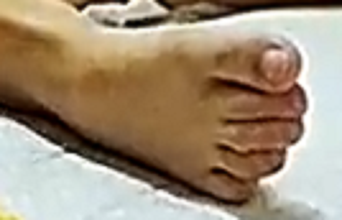 foot Gella 9-25-22 5